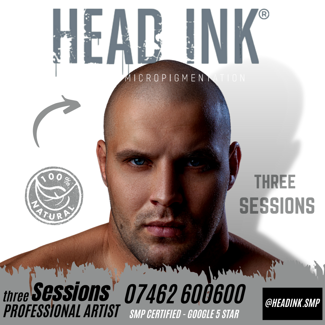 Scalp Micropigmentation A Modern Hair Loss Solution Scalp Micropigmentation Northampton